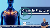 Clavicle Fracture